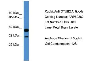 WB Suggested Anti-OTUB2  Antibody Titration: 0. (OTUB2 抗体  (Middle Region))
