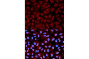 Immunofluorescence analysis of U2OS cells using SERPINC1 antibody. (SERPINC1 抗体  (AA 33-185))