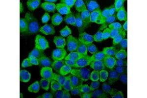 IF analysis of YB1 using anti-YB1 antibody (ABIN3043966).
