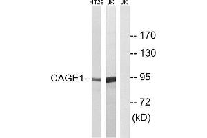 Western Blotting (WB) image for anti-Cancer Antigen 1 (CAGE1) (C-Term) antibody (ABIN1850982) (CAGE1 抗体  (C-Term))