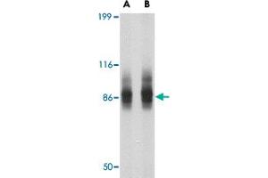 Western blot analysis of SP110 in SW480 cell lysate with SP110 polyclonal antibody  at (A) 1 and (B) 2 ug/mL . (SP110 抗体  (N-Term))