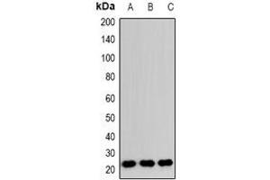 Western blot analysis of RAB24 expression in HeLa (A), RAW264. (RAB24 抗体)