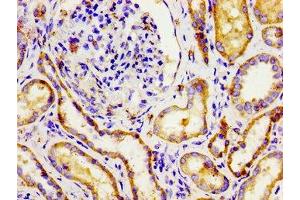 Immunohistochemistry of paraffin-embedded human kidney tissue using ABIN7145059 at dilution of 1:100 (NPR3 抗体  (AA 36-127))