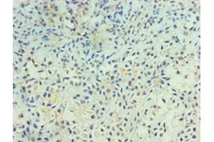 Immunohistochemistry (IHC) image for anti-Protein tyrosine Phosphatase, Receptor Type, A (PTPRA) (AA 20-142) antibody (ABIN7167500)