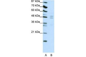 Western Blot showing TANK antibody used at a concentration of 1-2 ug/ml to detect its target protein. (TANK 抗体  (C-Term))