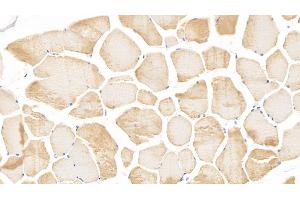 Detection of cTnI in Human Skeletal muscle Tissue using Monoclonal Antibody to Cardiac Troponin I (cTnI) (TNNI3 抗体  (AA 1-203))