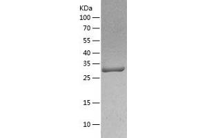 Western Blotting (WB) image for Mitochondrial Ribosomal Protein L1 (MRPL1) (AA 51-325) protein (His tag) (ABIN7288672) (MRPL1 Protein (AA 51-325) (His tag))