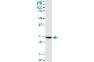 KLK10 polyclonal antibody (A01), Lot # 051011JC01. (Kallikrein 10 抗体  (AA 167-276))
