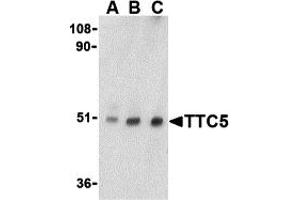 Western Blotting (WB) image for anti-Tetratricopeptide Repeat Domain 5 (TTC5) (C-Term) antibody (ABIN1030785) (TTC5 抗体  (C-Term))