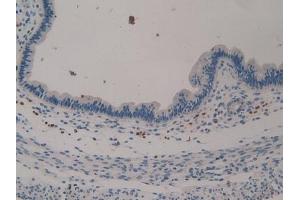 Detection of KL in Mouse Uterus Tissue using Polyclonal Antibody to Klotho (KL) (Klotho 抗体  (AA 516-955))