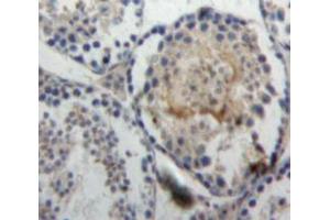Used in DAB staining on fromalin fixed paraffin-embedded Testis tissue
