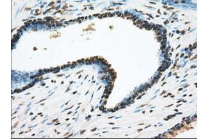 Immunohistochemical staining of paraffin-embedded Kidney tissue using anti-ACSBG1 mouse monoclonal antibody. (ACSBG1 抗体)