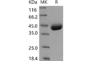 Western Blotting (WB) image for Interleukin 17 Receptor B (IL17RB) (Active) protein (His tag) (ABIN7320043)