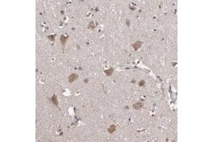 Immunohistochemical staining of human cerebral cortex with HECTD1 polyclonal antibody  shows moderate positivity in neurons at 1:50-1:200 dilution. (HECTD1 抗体)
