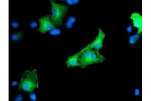 Anti-CCM2 mouse monoclonal antibody (ABIN2454943) immunofluorescent staining of COS7 cells transiently transfected by pCMV6-ENTRY CCM2 (RC201418). (CCM2 抗体)