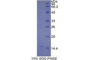 SDS-PAGE analysis of Mouse NAGase Protein.