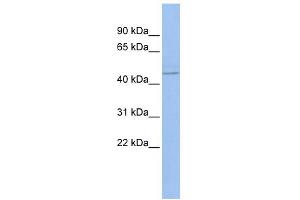 WB Suggested Anti-PML Antibody Titration:  0. (PML 抗体  (N-Term))