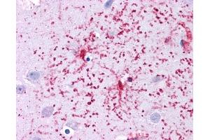 GLUD1 antibody was used for immunohistochemistry at a concentration of 4-8 ug/ml. (GLUD1 抗体  (N-Term))