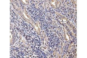 IHC analysis of EXOSC8 using anti-EXOSC8 antibody (ABIN7601850).