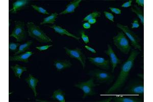 Immunofluorescence of monoclonal antibody to TRIP6 on HeLa cell. (TRIP6 抗体  (AA 1-100))