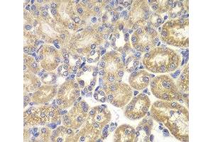 Immunohistochemistry of paraffin-embedded Rat kidney using PSMD9 Polyclonal Antibody at dilution of 1:200 (40x lens). (PSMD9 抗体)