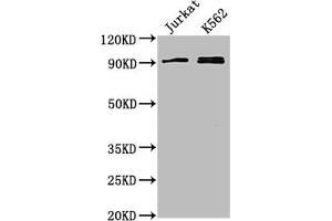 Western Blot Positive WB detected in: Jurkat whole cell lysate, K562 whole cell lysate All lanes: MARK2 antibody at 1:2000 Secondary Goat polyclonal to rabbit IgG at 1/50000 dilution Predicted band size: 88, 79, 84, 82, 81, 78, 87, 83, 80 kDa Observed band size: 88 kDa (MARK2 抗体  (AA 373-594))