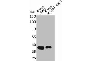 Western Blot analysis of mouse liver mouse spinal cord cells using Aldolase C Polyclonal Antibody (ALDOC 抗体  (N-Term))
