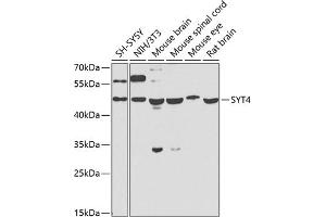 Western blot analysis of extracts of various cell lines, using SYT4 antibody (ABIN6129135, ABIN6148791, ABIN6148792 and ABIN6223676) at 1:1000 dilution. (SYT4 抗体  (AA 38-190))
