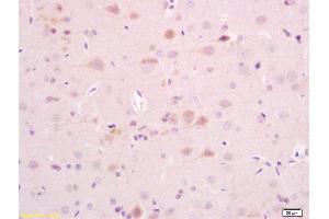 Formalin-fixed and paraffin rat brain tissue labeled with Anti-AKAP5 Polyclonal Antibody, Unconjugated (ABIN1387544) at 1:200, followed by conjugation to the secondary antibody and DAB staining (AKAP5 抗体  (AA 611-714))