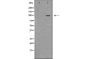 Western blot analysis of extracts of HeLa, using TLR5 antibody. (TLR5 抗体  (C-Term))