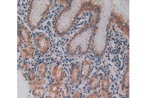 IHC-P analysis of stomach tissue, with DAB staining. (Keratin 3 抗体  (AA 198-514))