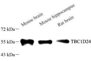 Western blot analysis of TBC1D24 (ABIN7075847) at dilution of 1: 1000 (TBC1D24 抗体)