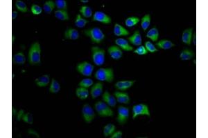 Immunofluorescence staining of Hela cells with ABIN7163832 at 1:200, counter-stained with DAPI. (PKD1 抗体  (AA 615-753))