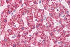 Human Liver (formalin-fixed, paraffin-embedded) stained with IFIH1 antibody ABIN337077 at 5 ug/ml followed by biotinylated goat anti-rabbit IgG secondary antibody ABIN481713, alkaline phosphatase-streptavidin and chromogen. (IFIH1 抗体  (Internal Region))
