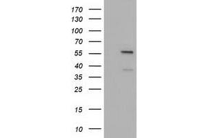 HEK293T cells were transfected with the pCMV6-ENTRY control (Left lane) or pCMV6-ENTRY DYNC1LI1 (Right lane) cDNA for 48 hrs and lysed. (DYNC1LI1 抗体)