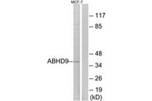 Western blot analysis of extracts from MCF-7 cells, using ABHD9 Antibody. (ABHD9 抗体  (AA 101-150))