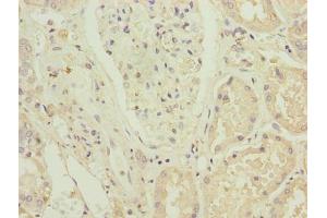Immunohistochemistry of paraffin-embedded human kidney tissue using ABIN7176421 at dilution of 1:100 (ZNF596 抗体  (AA 201-504))