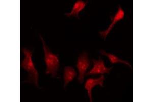 ABIN6274120 staining A549 by IF/ICC. (SLC43A1 抗体  (Internal Region))