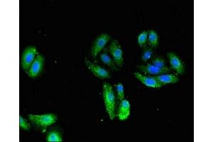 Immunofluorescent analysis of HepG2 cells using ABIN7173582 at dilution of 1:100 and Alexa Fluor 488-congugated AffiniPure Goat Anti-Rabbit IgG(H+L) (TNNI1 抗体  (AA 2-173))