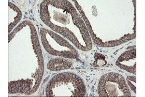 Image no. 10 for anti-Diphthamide Biosynthesis Protein 2 (DPH2) antibody (ABIN1497892)