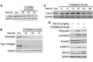 Western Blotting (WB) image for anti-Collagen, Type I (COL1) antibody (ABIN5596819)