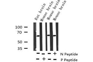 Western blot analysis of Phospho-p62 Dok (Tyr362) expression in various lysates