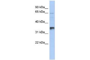 WB Suggested Anti-UBAC2 Antibody Titration: 0. (UBAC2 抗体  (Middle Region))