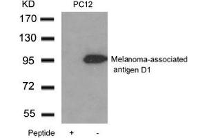 Western blot analysis of extracts from PC12 cells using Melanoma-associated antigen D1and the same antibody preincubated with blocking peptide. (MAGED1 抗体  (C-Term))