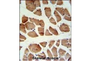 Immunohistochemistry (Paraffin-embedded Sections) (IHC (p)) image for anti-ATPase, Ca++ Transporting, Cardiac Muscle, Fast Twitch 1 (ATP2A1) (AA 974-1001), (C-Term) antibody (ABIN1881089)