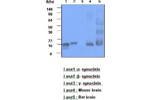 The recombinant human synuclein family (alpha-,beta- and gamma-) (each 20ng), Mouse brain and Rat brain (30 ug) were resolved by SDS-PAGE, transferred to PVDF membrane and probed with anti-human alpha,beta-synuclein (1:1000). (alpha (AA 119-140) 抗体)