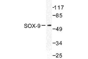 Image no. 1 for anti-SRY (Sex Determining Region Y)-Box 9 (SOX9) antibody (ABIN272082)