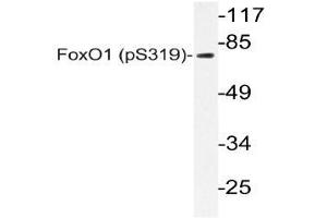 Western blot (WB) analyzes of p-FoxO1 antibody in extracts from 293 SERUM cells. (FOXO1 抗体  (pSer319))