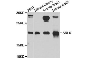 Western blot analysis of extracts of various cell lines, using ARL6 antibody. (ARL6 抗体)