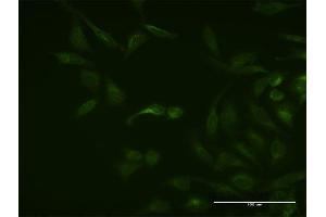 Immunofluorescence of monoclonal antibody to ASB3 on HeLa cell. (ASB3 抗体  (AA 1-518))